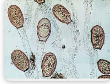 <p>Chytridiomycota</p>