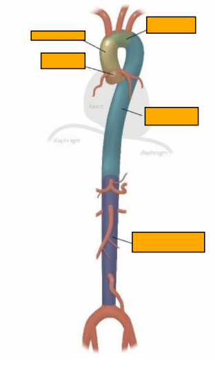 <p>Label this image </p>