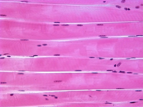 structure: long cylindrical striated muscle fibers, cells are multinucleated
location: attached to skeleton
Voluntary 
Function: produces movement of the body