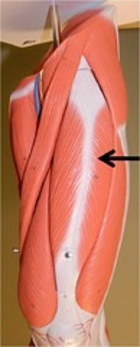 <p>origin: ileum and acetabalum<br>insertion: tibial tuberosity <br>action: extension at knee, flexion at hip</p>