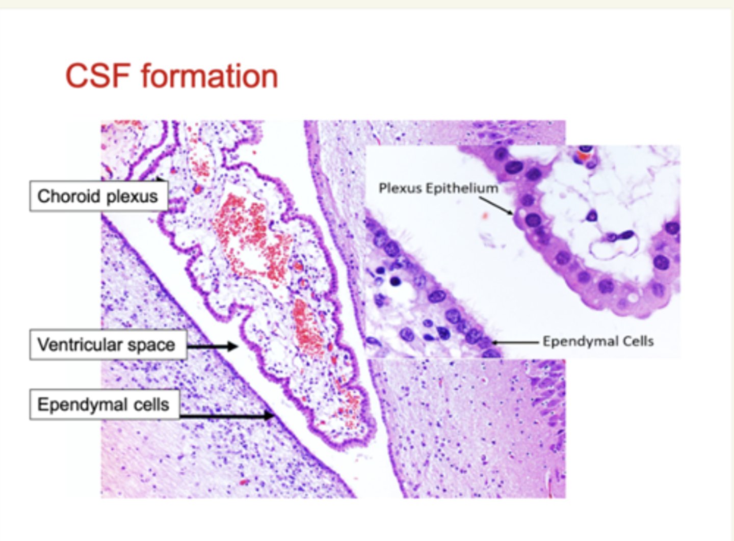 <p>By active secretion from the choroid plexus epithelial cells.</p>