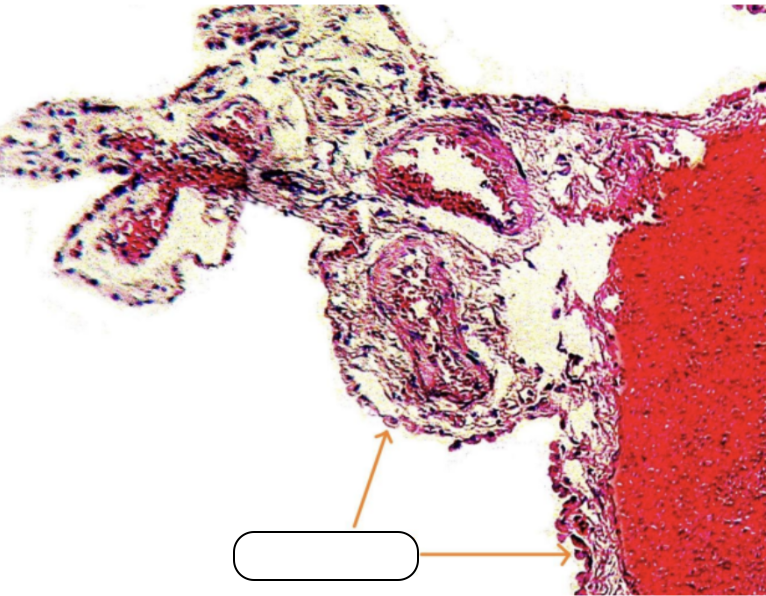 <p>Identify the structure pointed by the arrow.</p>