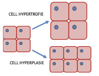 <ul><li><p><span><strong><span>Hyperkeratose</span></strong></span>: een verdikking van de hoornlaag.</p></li><li><p><span><strong><span>Acanthose</span></strong></span>: aantal cellagen huid is toegenomen (dus hyperplasie), verhoogde groei van weefsel</p></li><li><p><span><strong><span>Hypertrofie</span></strong></span>: celvergroting</p></li><li><p><span><strong><span>Hyperplasie</span></strong></span>: vermeerdering van cellen</p></li></ul><p></p>