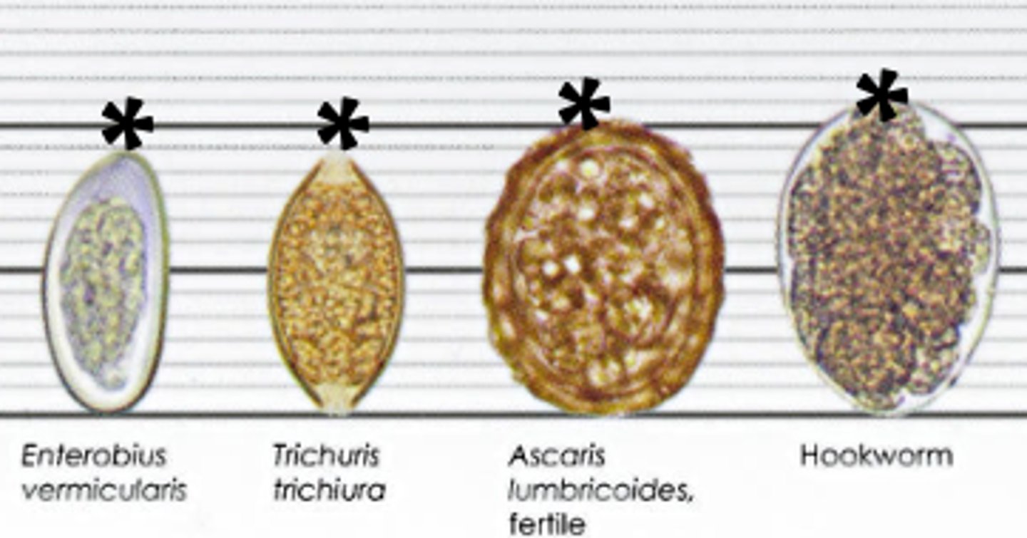 <p>•Enterobius vermicularis (pinworm)</p><p>•Trichuris trichiura (whipworm)</p><p>•Ascaris lumbricoides</p><p>•Hookworms</p><p>•Strongyloides stercoralis</p>