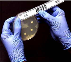 an area of media where bacteria are unable to grow, due to the presence of a drug that impedes their growth

measure the diameter with a ruler