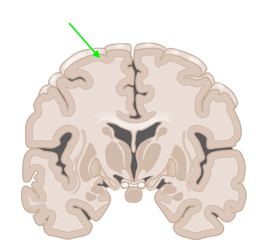 <ul><li><p><span style="background-color: transparent;">cell bodies</span></p></li><li><p><span style="background-color: transparent;">Outer parts of the cortex</span></p></li></ul><p></p>