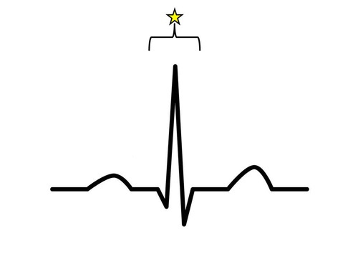 <p>shows depolarization/excitation of ventricles, followed by ventricular systole (contraction)</p>