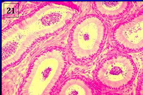 <p>Identify the structure:</p><p>Specie:</p><p>Lined by:</p>