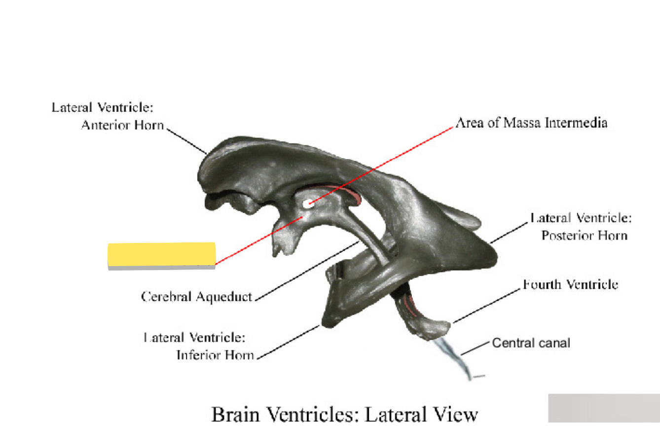 <p>Name this brain ventricle </p>