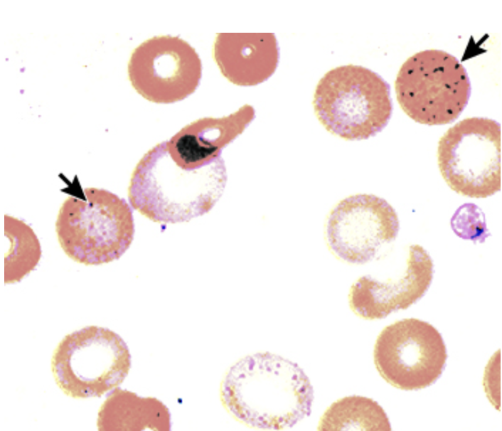 <p>Diagnostic findings in Lead poisonings</p>