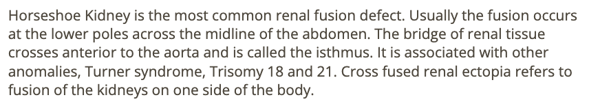 <p>a) horseshoe kidney</p>