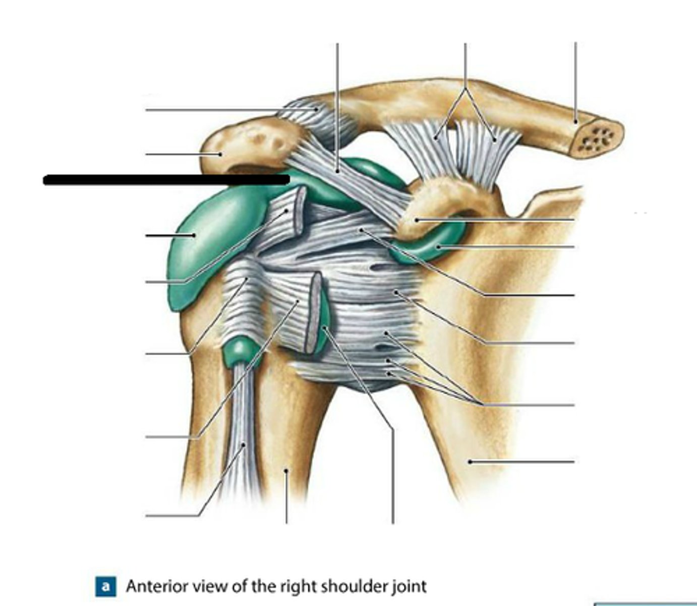 <p>bursa that protects the supraspinatus muscle tendon and superior end of the humerus from rubbing against the acromion of the scapula</p>
