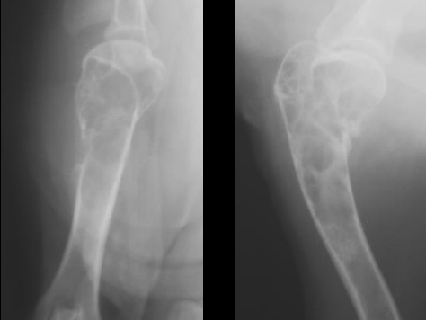 <p>Primary Bone Neoplasia</p>