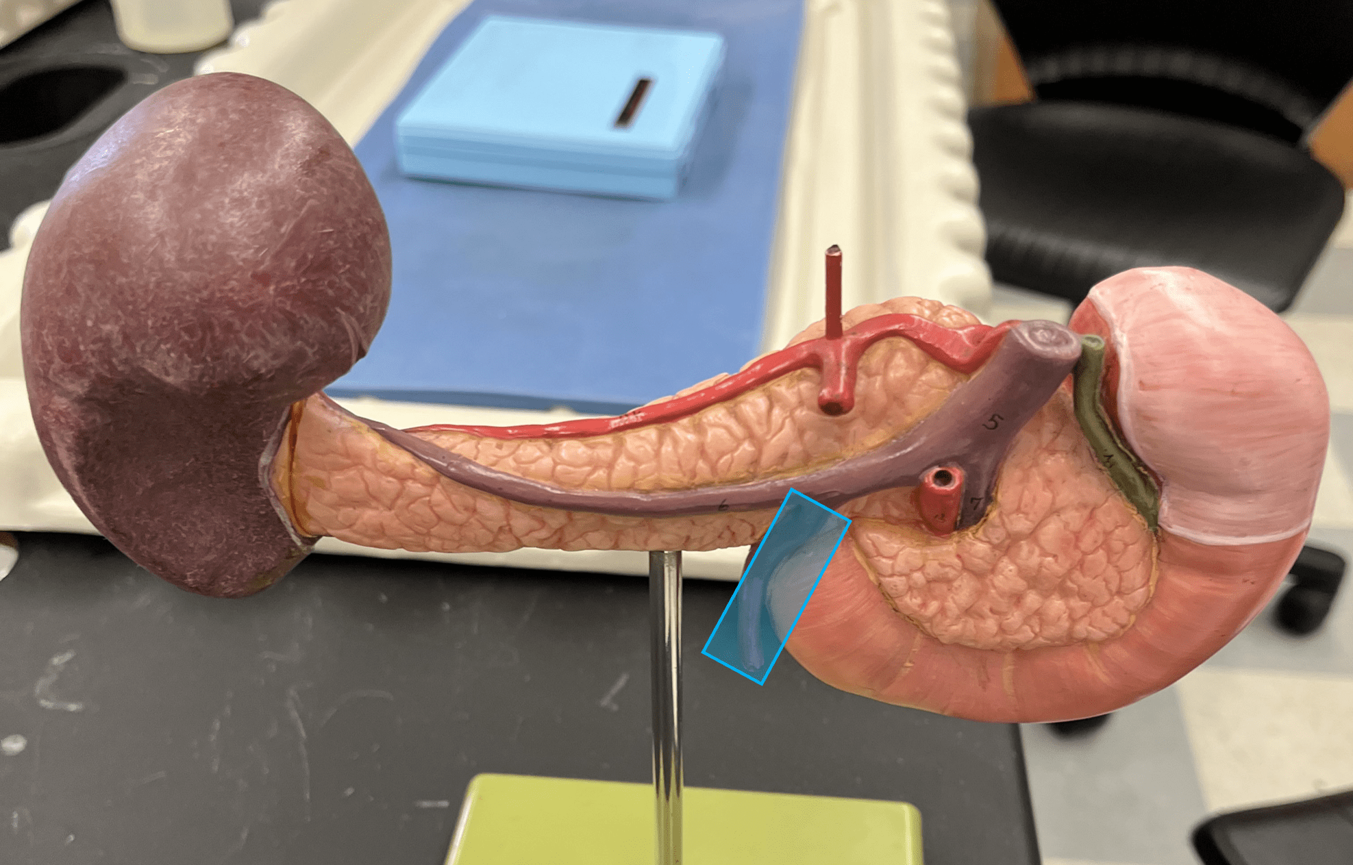 <p>• A vein of the hepatic portal system.</p>
<p>• Drains the rectum and distal colon.</p>
<p>• Empties into the splenic vein.</p>