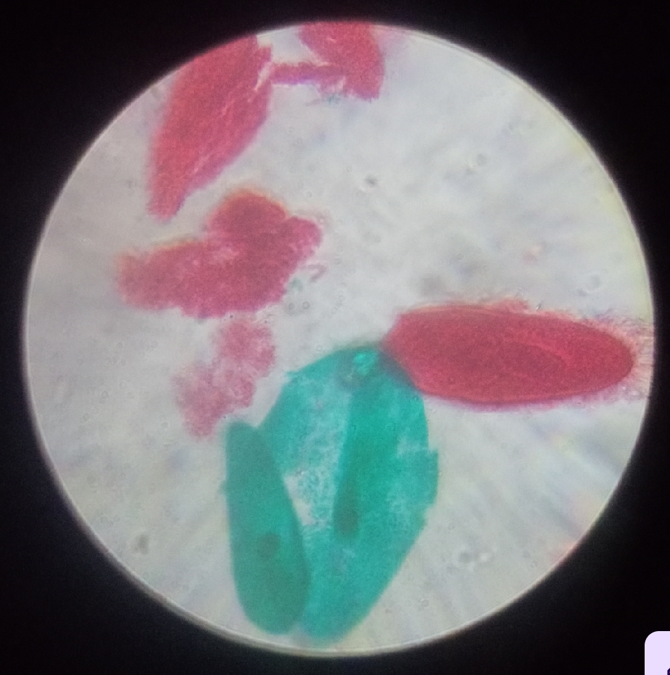<p>_______ reproduces asexually through transverse binary fission, where one cell splits into two genetically identical daughter cells.</p><p>This process occurs under favorable conditions—ample nutrients and optimal temperature.</p>