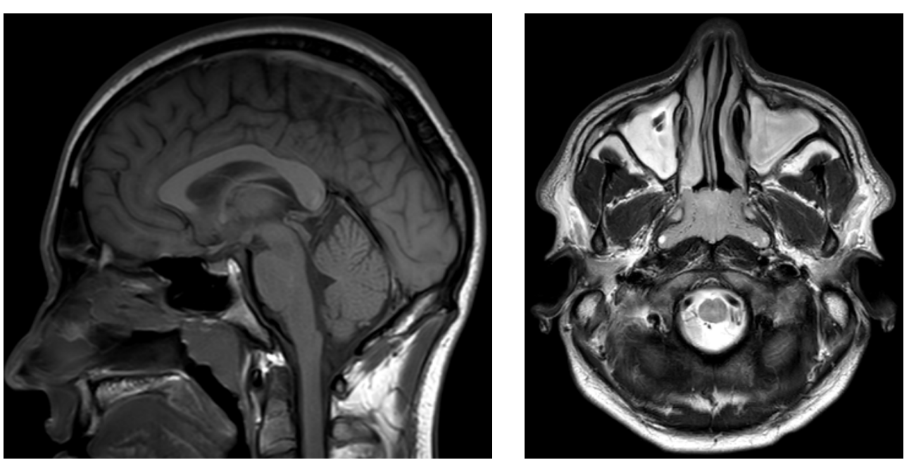 <p>What can be seen in this MRI image?</p>