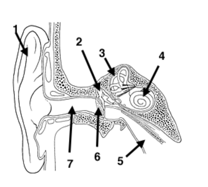 <p>What is 3 Pointing to?</p>