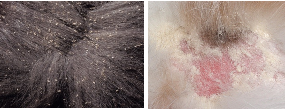 <p>cheyletiella = right —> causes bigger hypersens reaction = lots of scale (walking dandruff)</p><p>pediculosis = left (lice)</p>