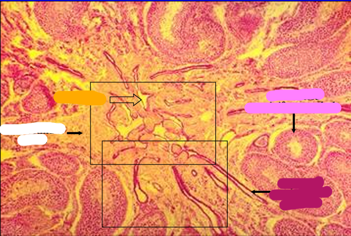 <p>Identify the cut:</p><p>Identify the structure:</p><p>Specie:</p><p>Orange:</p><p>White:</p><p>Pink:</p><p>Magenta:</p>