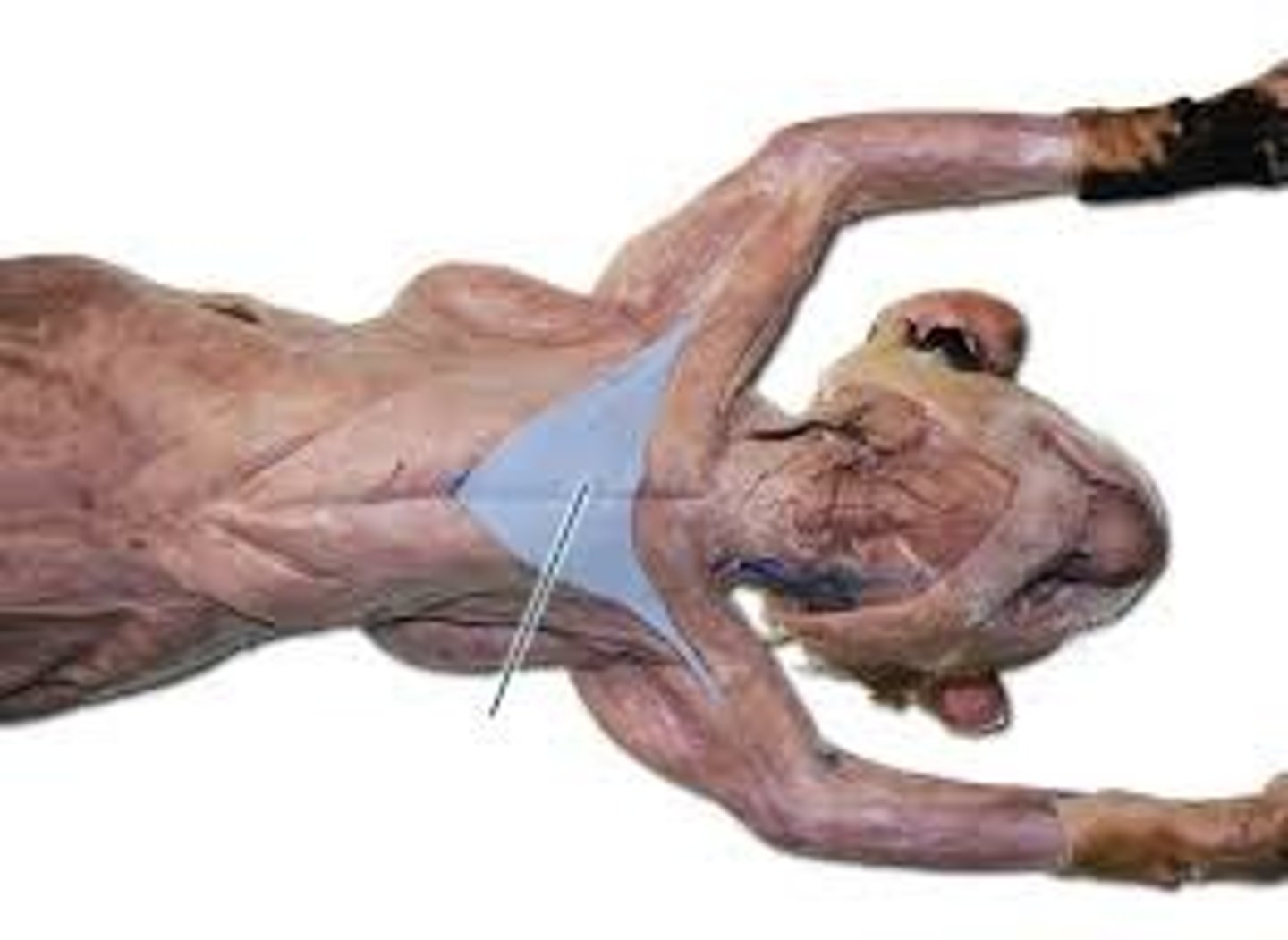 <p>name this muscle</p>