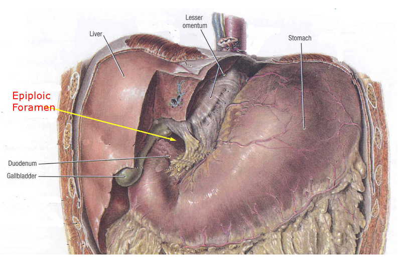 <p>Epiploic foramen of the omental bursa (lesser sac) opens into its left part.</p><p><strong>B. No</strong></p><p></p>