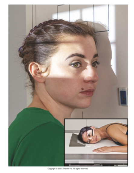 <p>What <u>lines</u> are used for <strong>RT and LT lateral </strong>method for <strong>skull</strong>?</p>