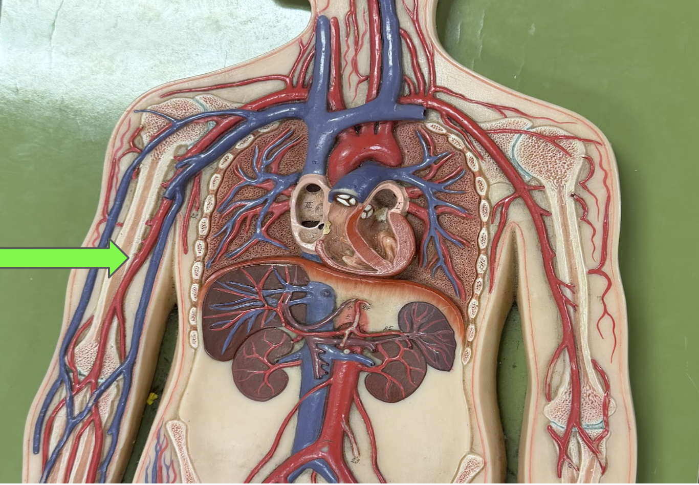 <p>What artery is this </p>