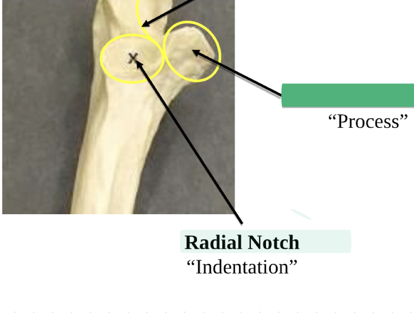 <p>Radial notch </p>