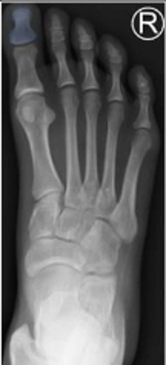 <p>What is outlined?</p>