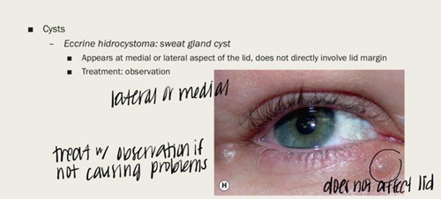 <p>sweat gland cyst</p>