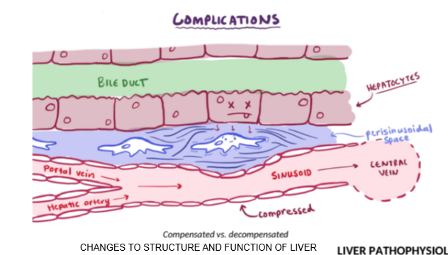 <p>Because impaired bile and blood flow slows drug metabolism and excretion, increasing the risk of toxicity.</p>