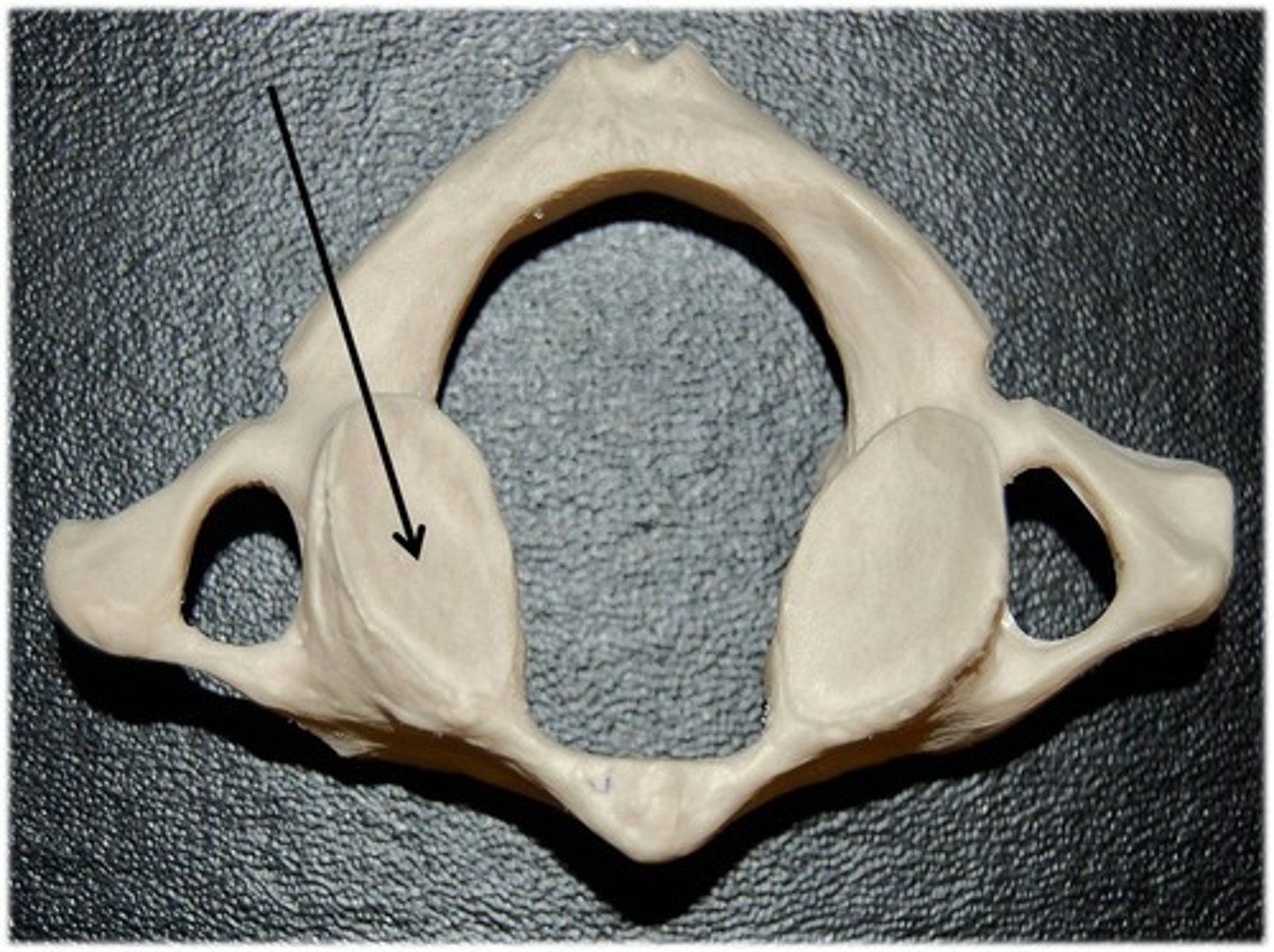 <p>a smooth area for bone to bone attachment</p>