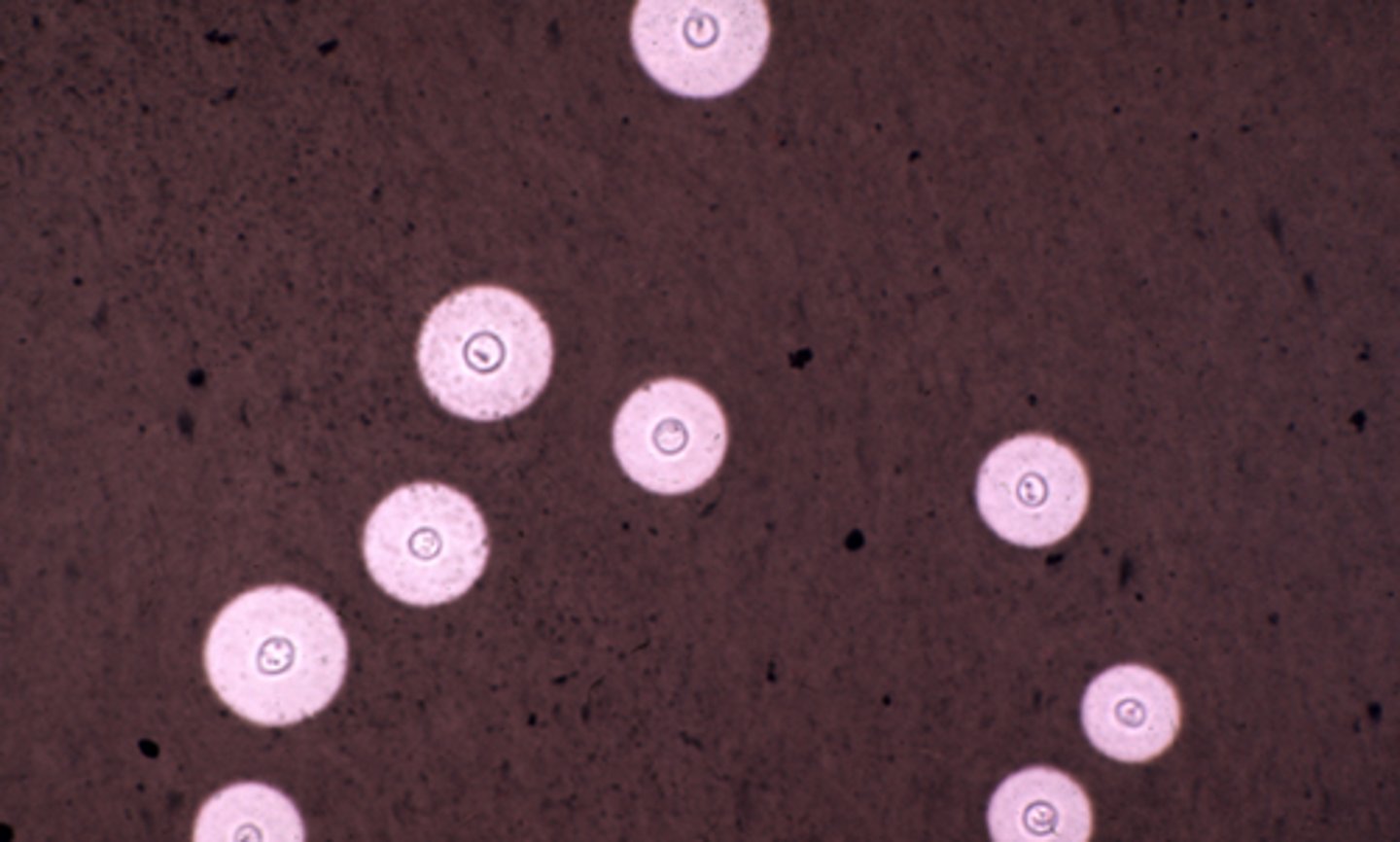 <p>Reagent:</p><p>India ink or nigrosin stain</p><p>-Routinely utilized for staining CSF</p><p>Demonstrate large capsules enveloping blastospores of Cryptococcus neoformans</p>