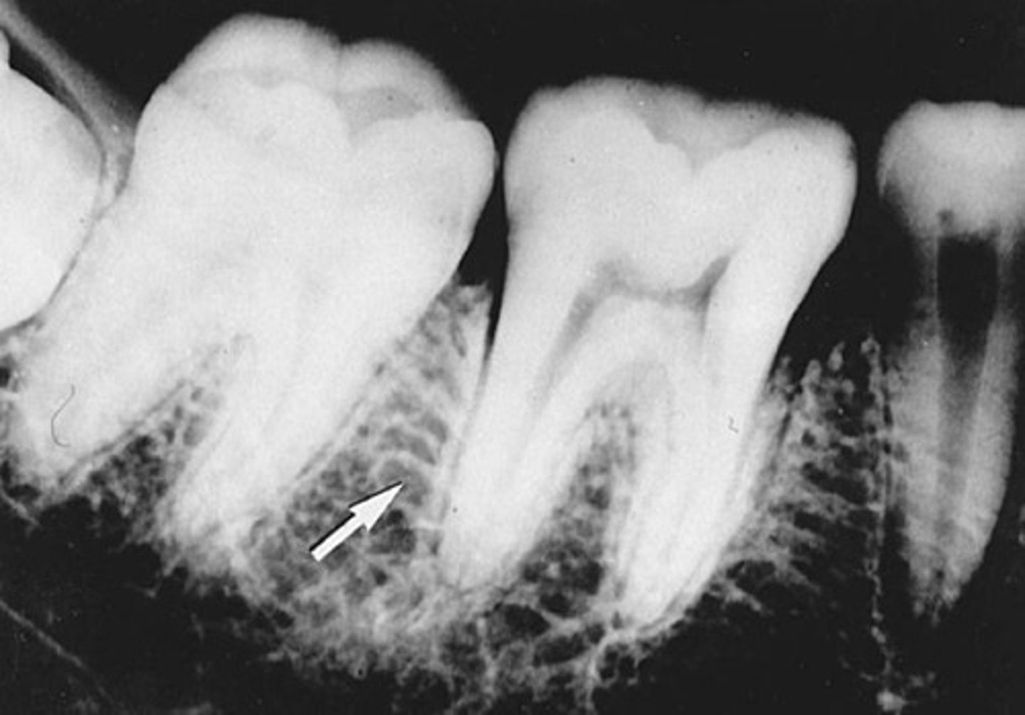 <p>What kind of bone is shown here?</p>