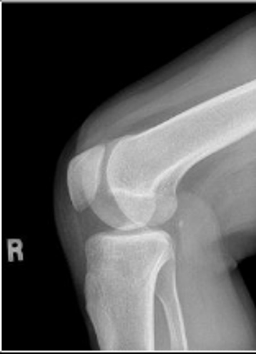 <p>What is the name of the radiographic view?</p>