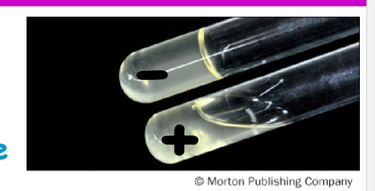 <p>gelatin hydrolysis test results</p>