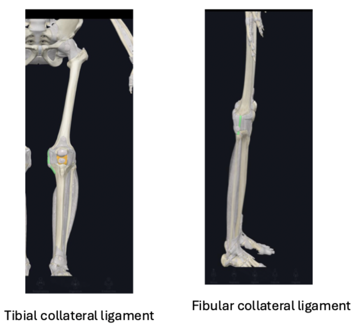 <ul><li><p><strong>collateral ligaments: </strong>during knee extension, the ligaments are taut and during knee flexion, they are loose (which allows for a little rotation)</p><ul><li><p><strong>tibial or medial collateral ligament:</strong></p><ul><li><p>fused to the joint capsule and the meniscus</p></li><li><p>function: stabilize the knee joint during knee ROM</p></li></ul></li><li><p><strong>fibular or lateral collateral ligament:</strong></p><ul><li><p>attaches into the head of the fibula</p></li><li><p>not fused to joint capsule or meniscus- so more flexibility</p></li><li><p>function: stabilize the knee joint during knee ROM</p></li></ul></li></ul></li></ul><p></p>