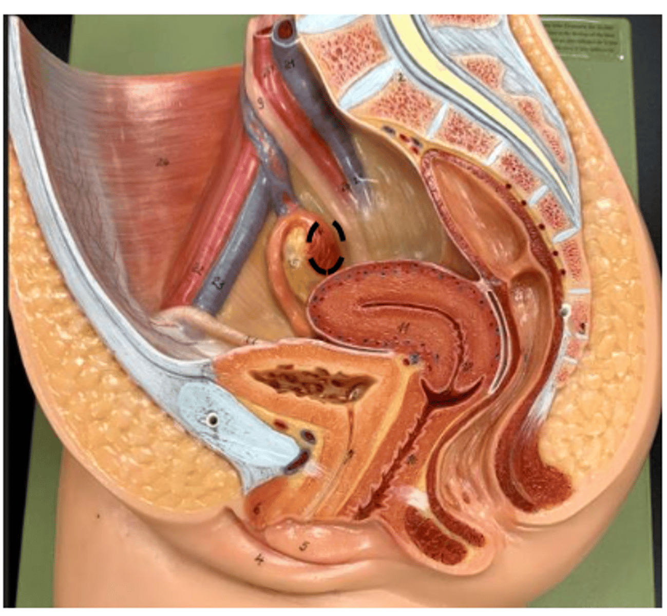 <p>finger light structure</p>