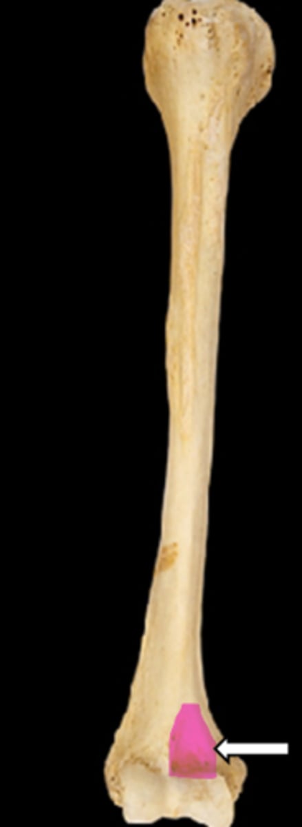 <p>name the part</p>