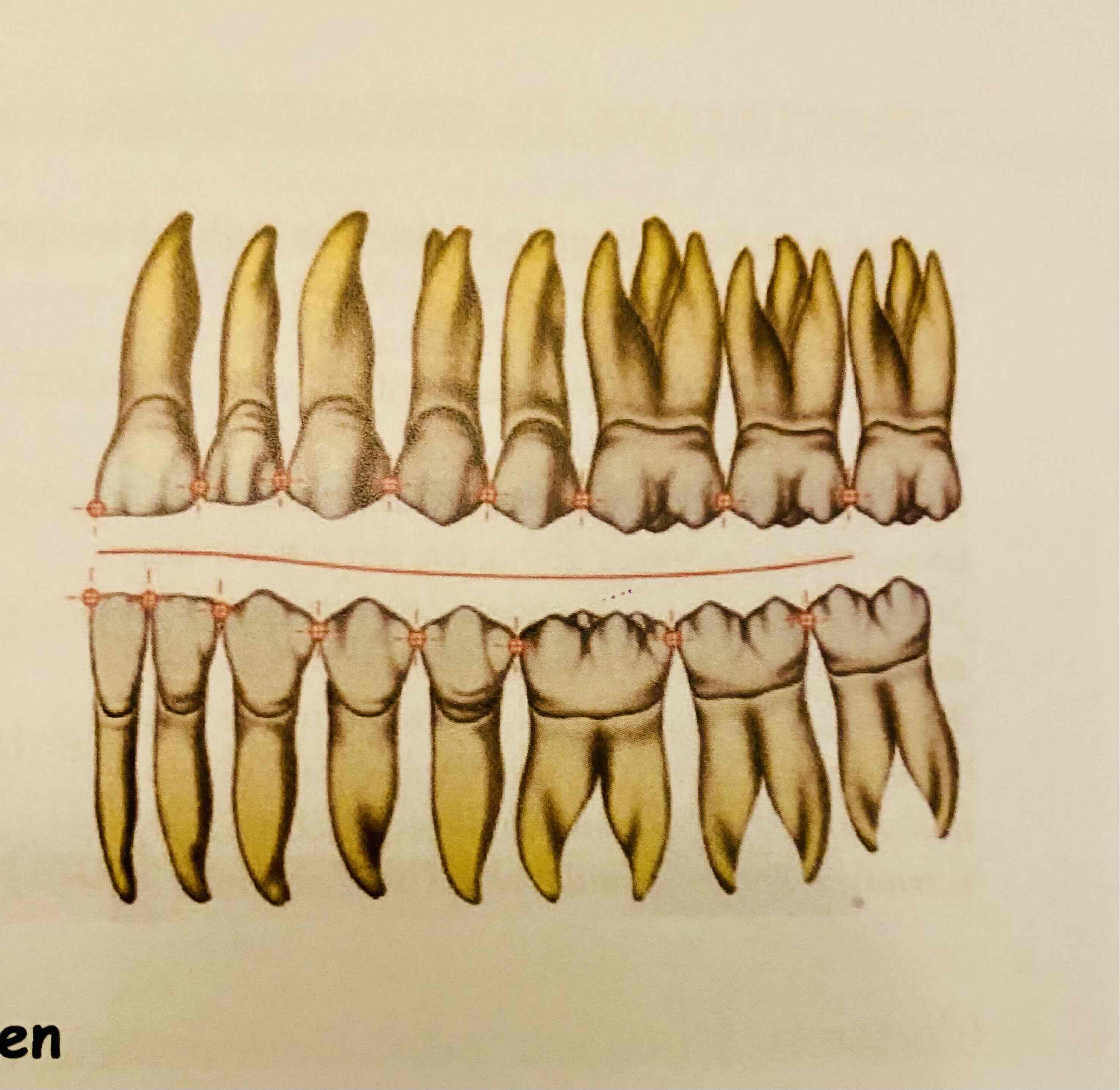 <p>Punt of zone op het proximale vlak dat in contact komt met buurtand in dezelfde boog. Mediaal en distaal is er een contactpunt, met uitz v de laatste tanden i</p>
