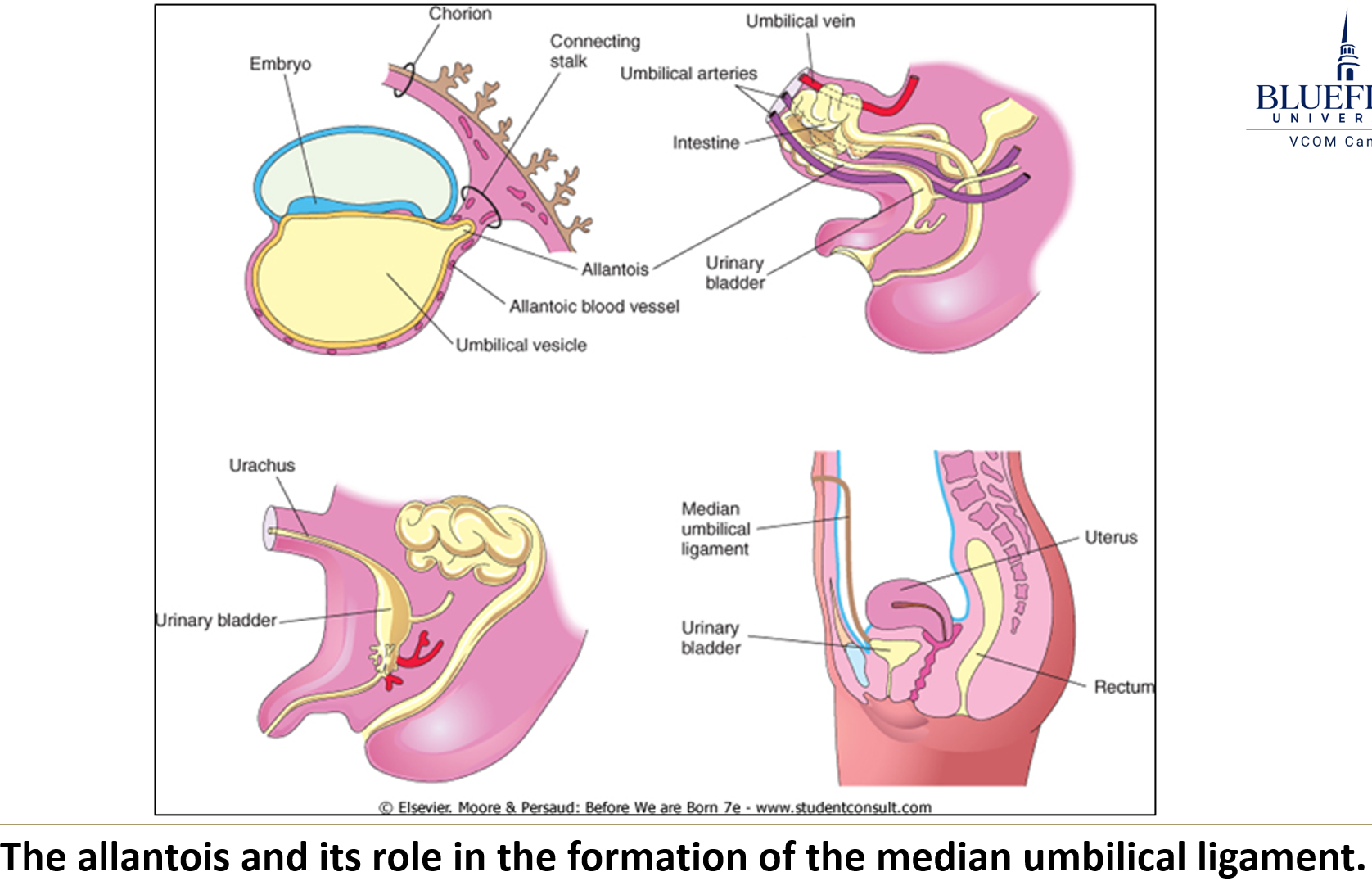 <p>A <strong>diverticulum (</strong>small pouch) off the <strong>yolk sac</strong>, extending into the <strong>connecting stalk</strong>.</p>