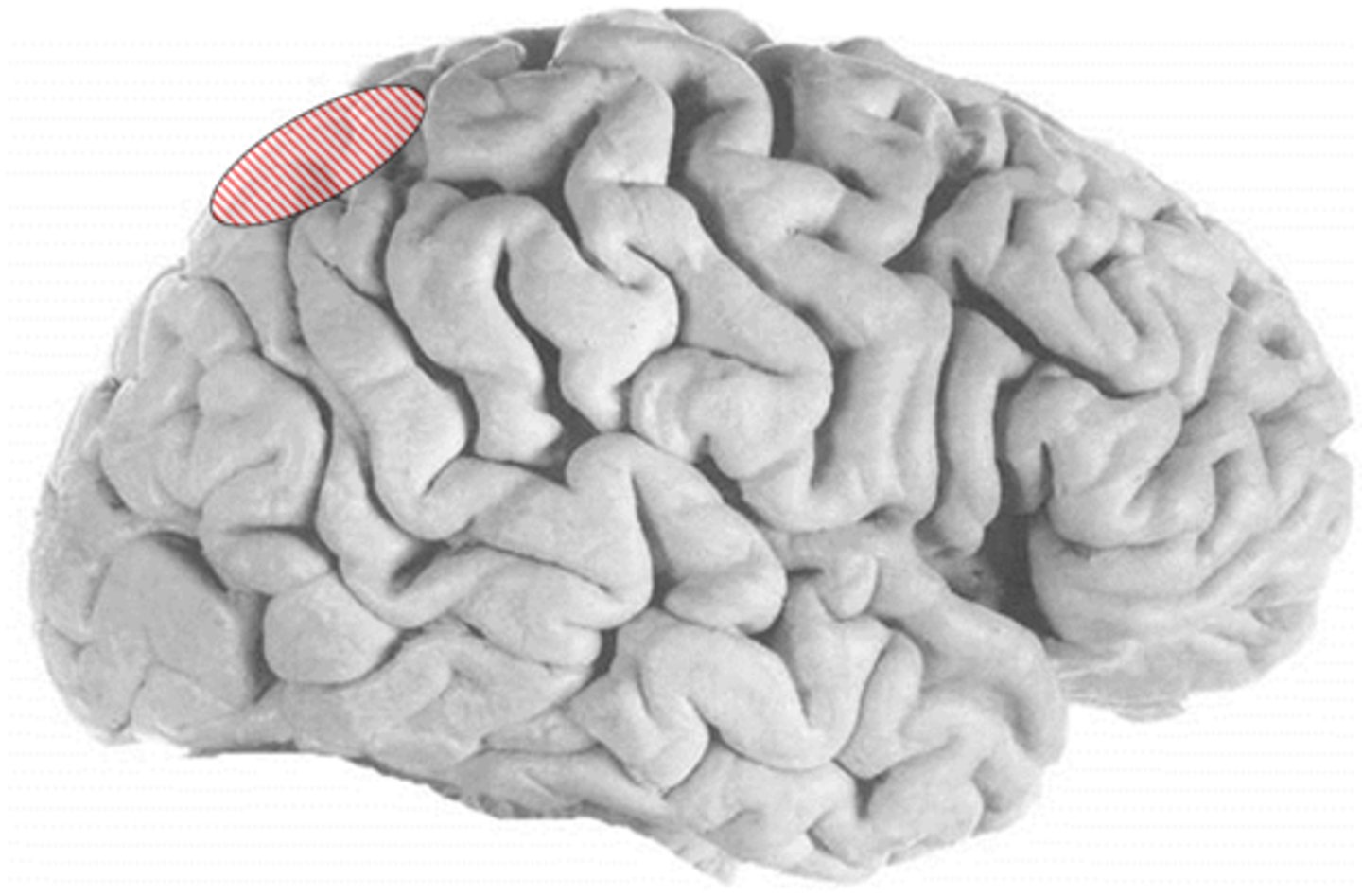 <p>ID</p>