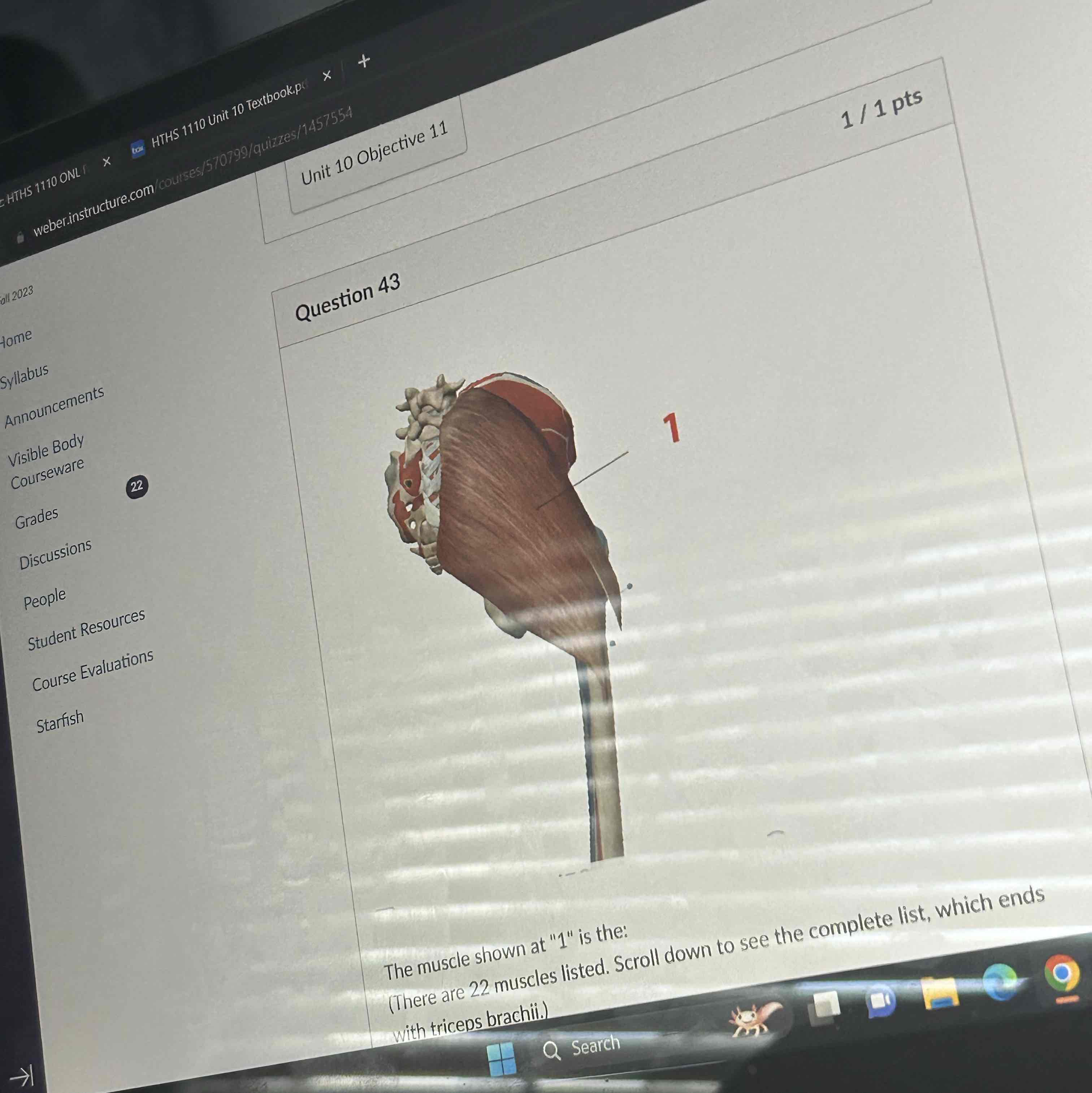 <p>The muscle shown at 1 is the </p>