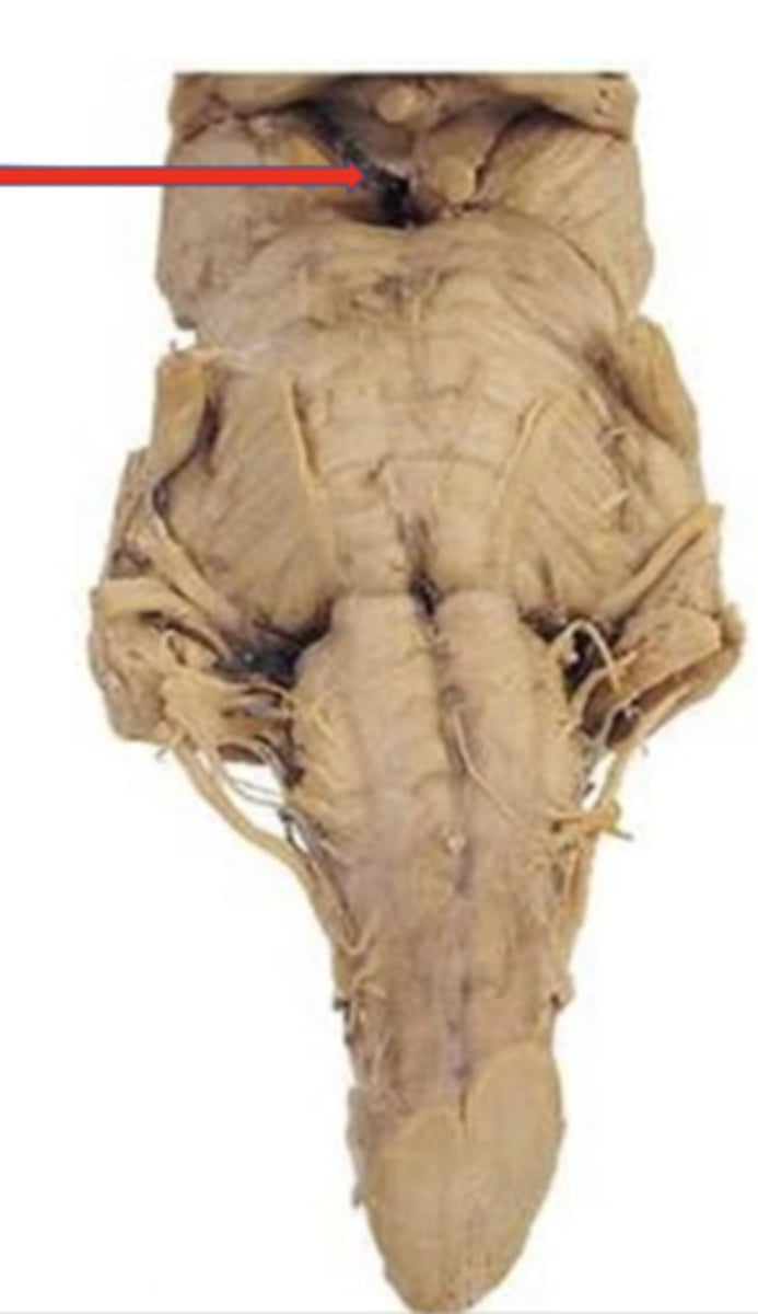 <p>space between cerebral peduncles</p>