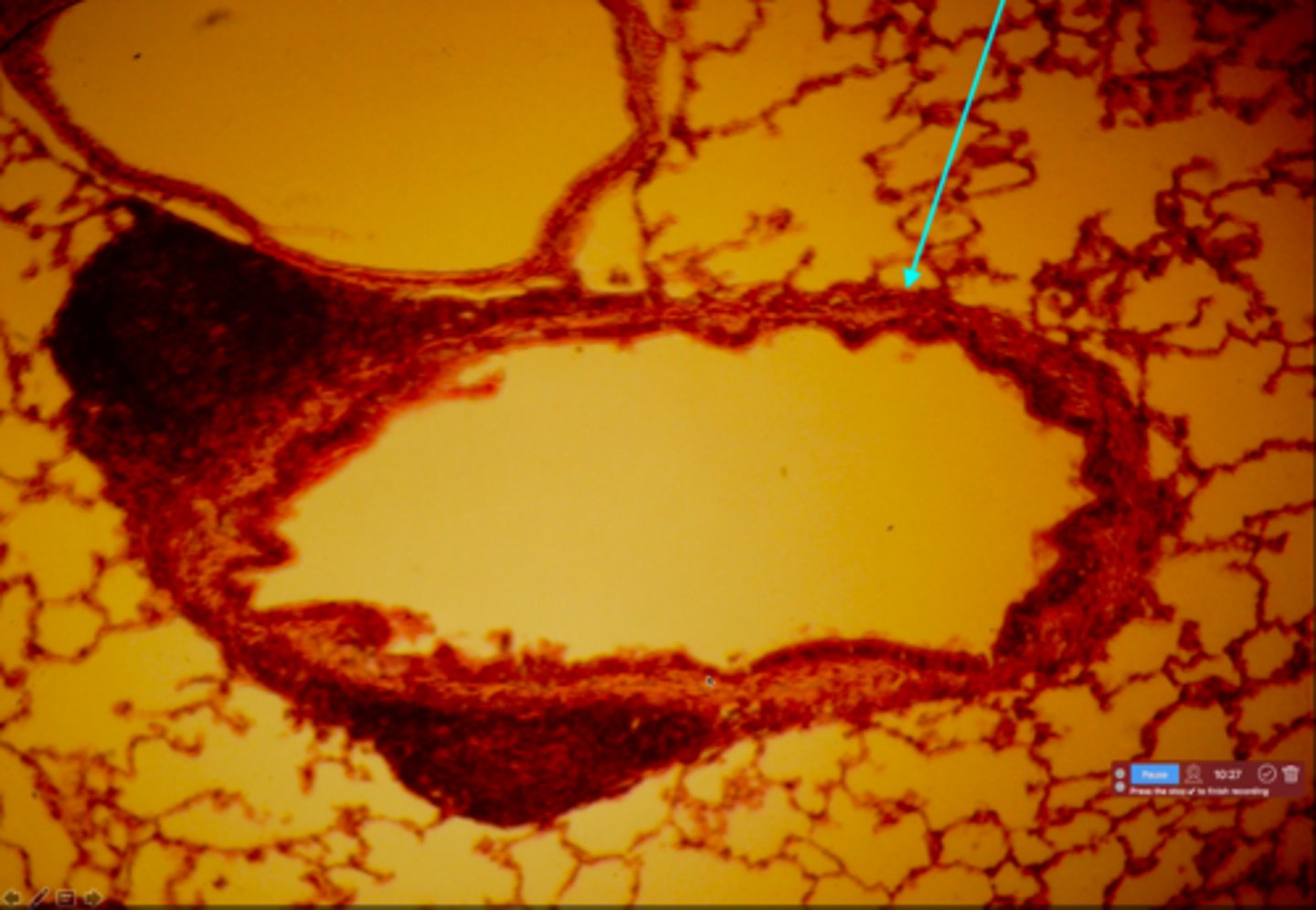 <p>This is a slide showing an interlobular bronchiole. What type of cells lines this bronchiole?</p>