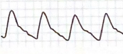 <p>Use terms to describe the peak, amplitude and downslope of the following waveform.</p>