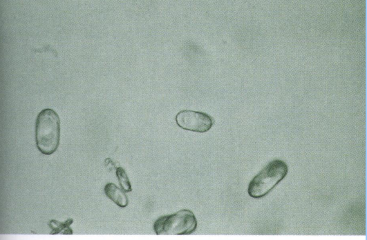 <p>What are these?</p>