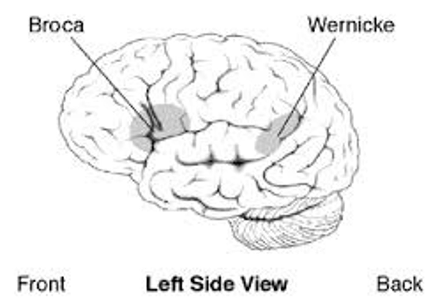 <p>impairment of language, usually caused by left hemisphere damage either to Broca's area (impairing speaking) or to Wernicke's area (impairing understanding).</p>