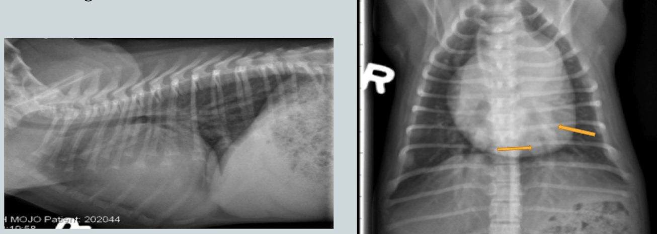 <p>What lung pattern? </p>
