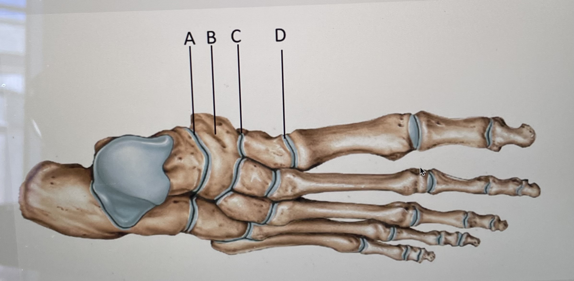 Identify the joint marked A 
